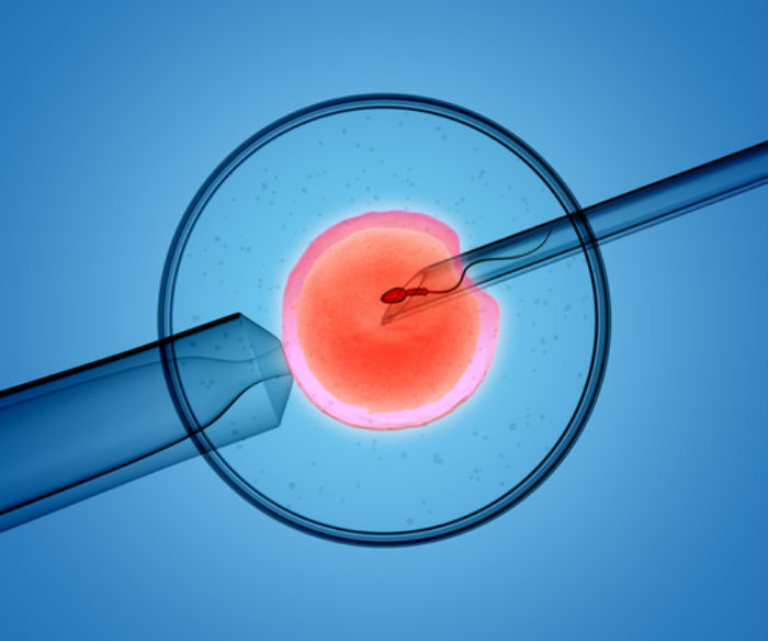 animated image of in vitro fertilization. A needle inserts a sperm into an egg. 