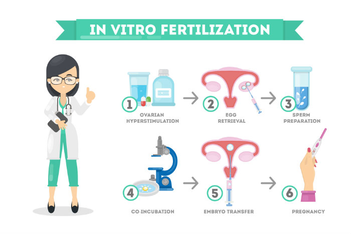 In vitro fertilization infographic