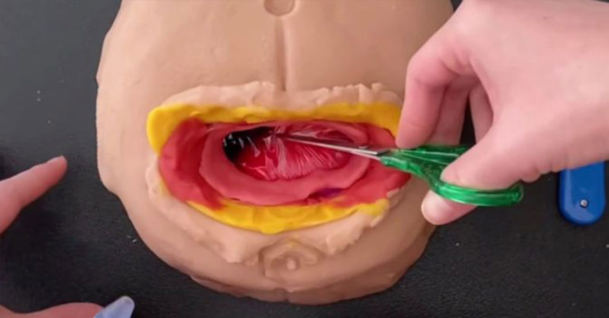 play-doh c-section