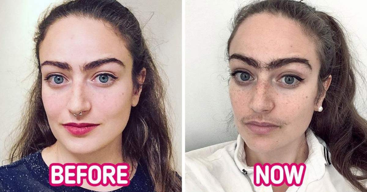 A Woman Stopped Removing Facial Hair And a Year Later Shares How It Ch...
