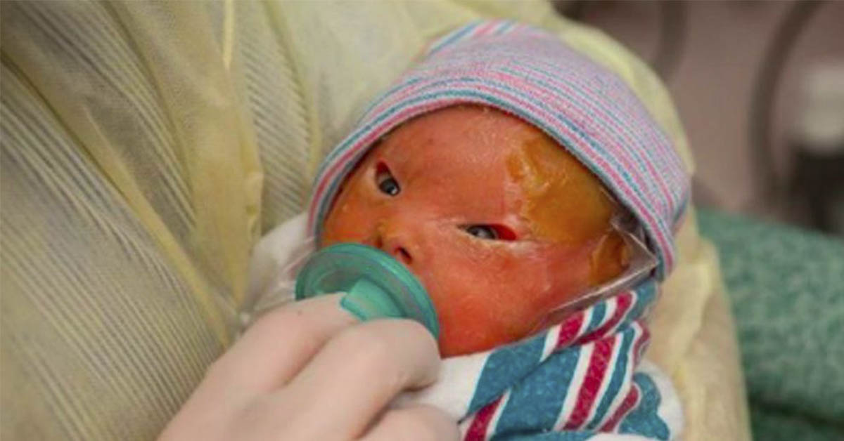 Parents Are Devastated When They See Newborn Girl, But Take A Look At ...